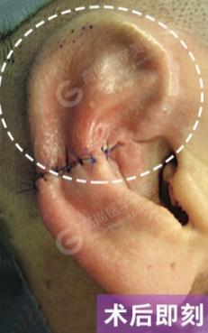 对耳轮视频,视频揭秘耳轮的形态与魅力